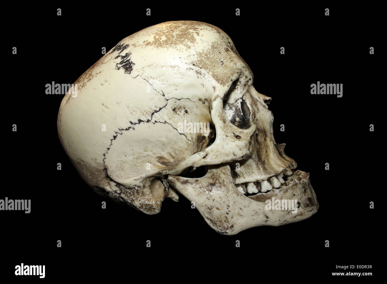 Gladiador romano cráneo humano Vista lateral Foto de stock