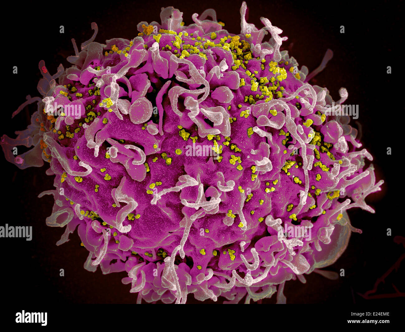 Infectadas por el VIH de células t h9 Foto de stock