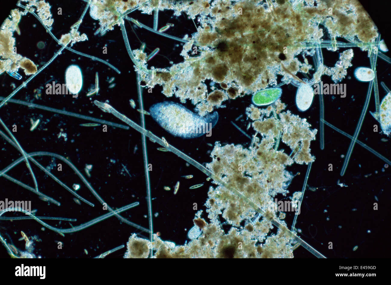La vida del estanque mostrando ciliados, diatomeas y algas Foto de stock