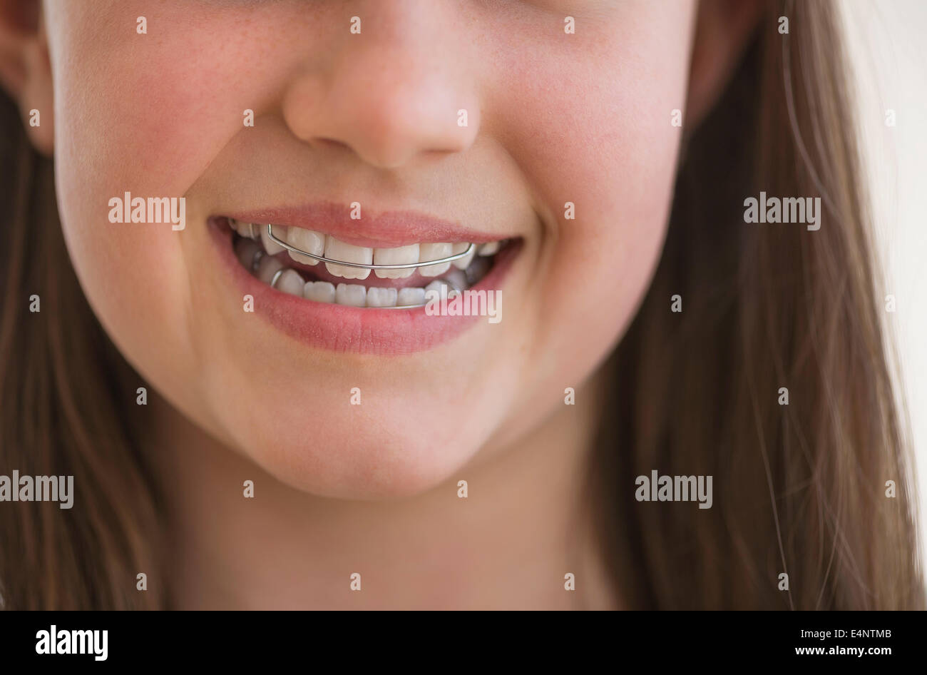 Chica (10-11) usando abrazaderas dentales sonriendo Foto de stock