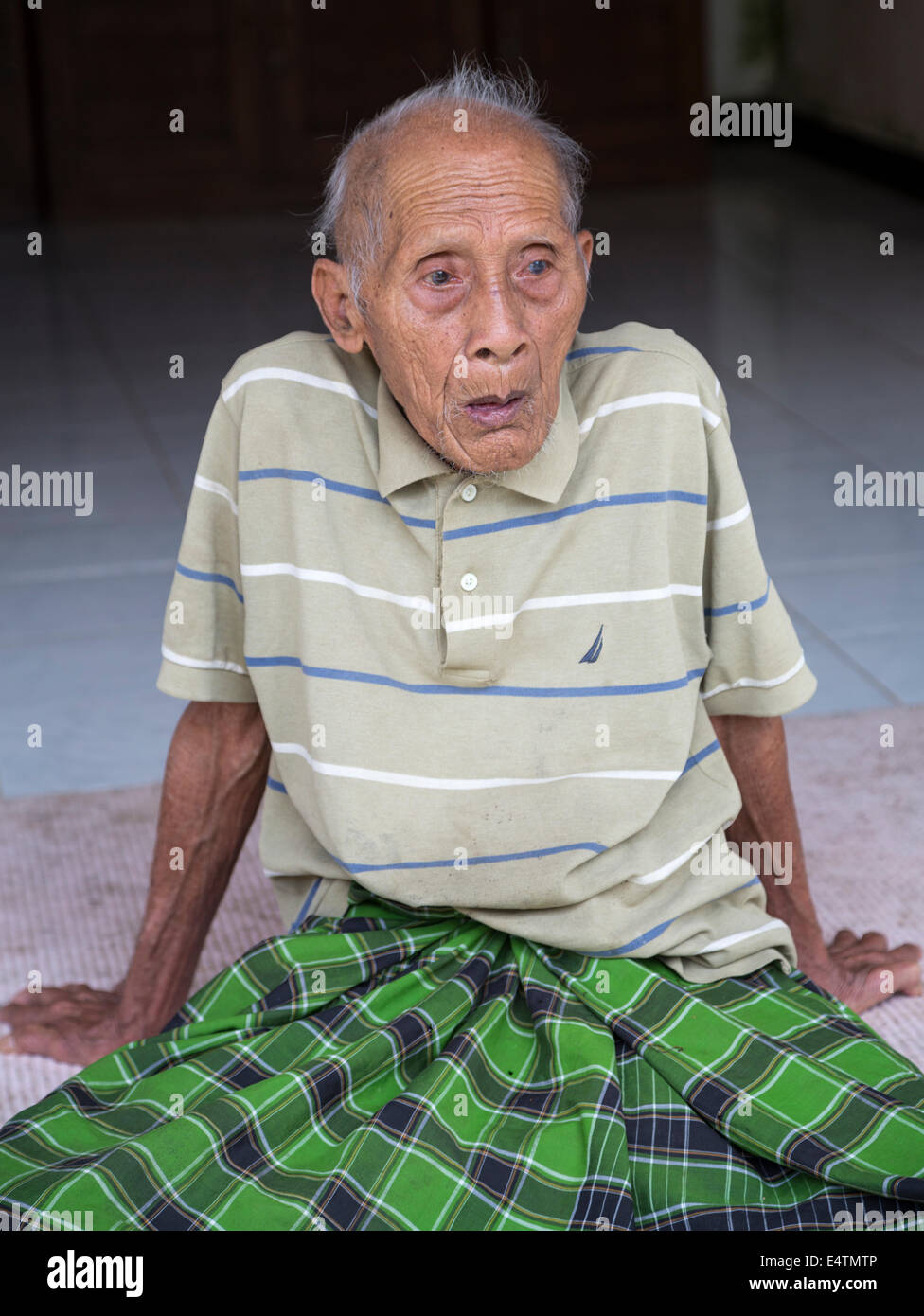 Bali, Indonesia. Viejo hombre balinesa hindú sufre de catarata-visión disminuida. Foto de stock