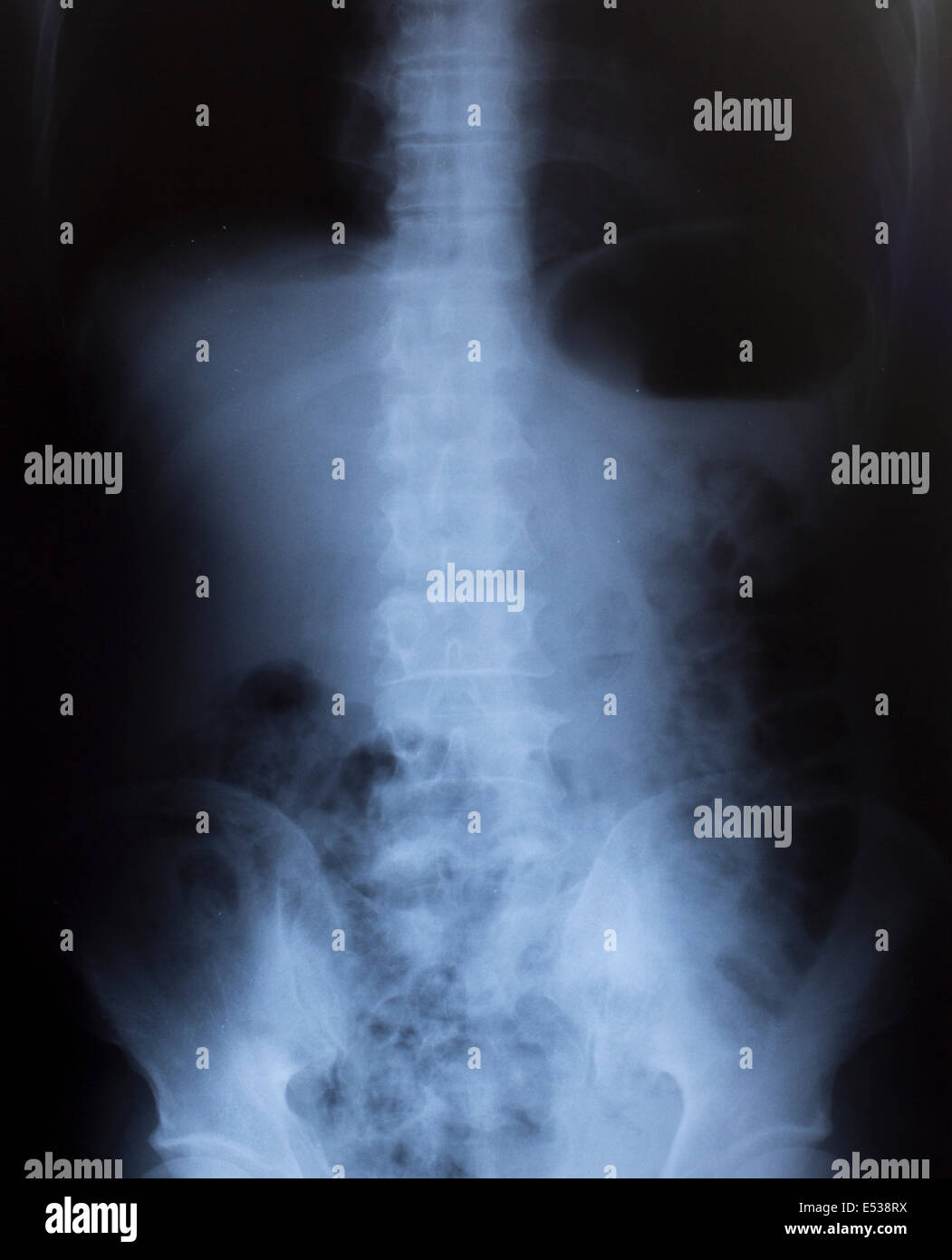 Imagen de rayos X de tórax humano para un diagnóstico médico Fotografía