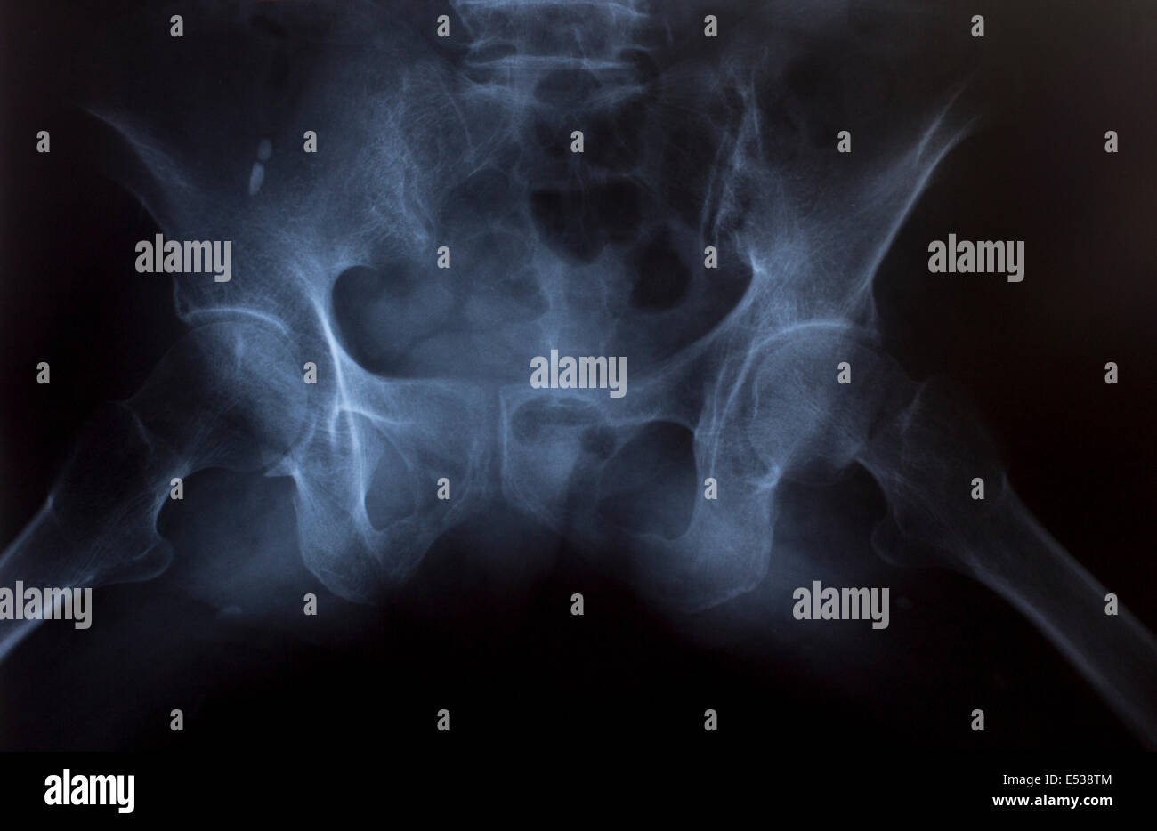 Imagen de rayos X de tórax humano para un diagnóstico médico Fotografía