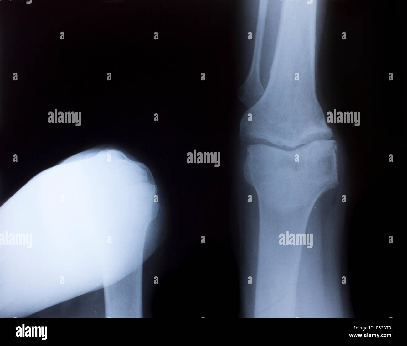 Imagen de rayos X de tórax humano para un diagnóstico médico Fotografía