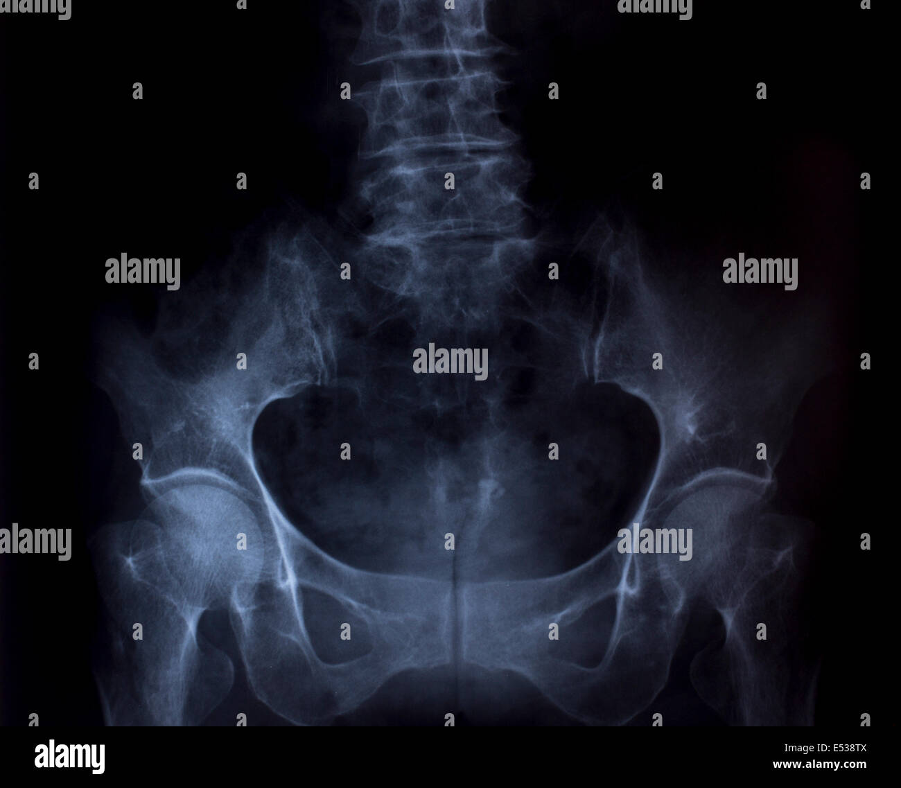 Imagen de rayos X de tórax humano para un diagnóstico médico Fotografía