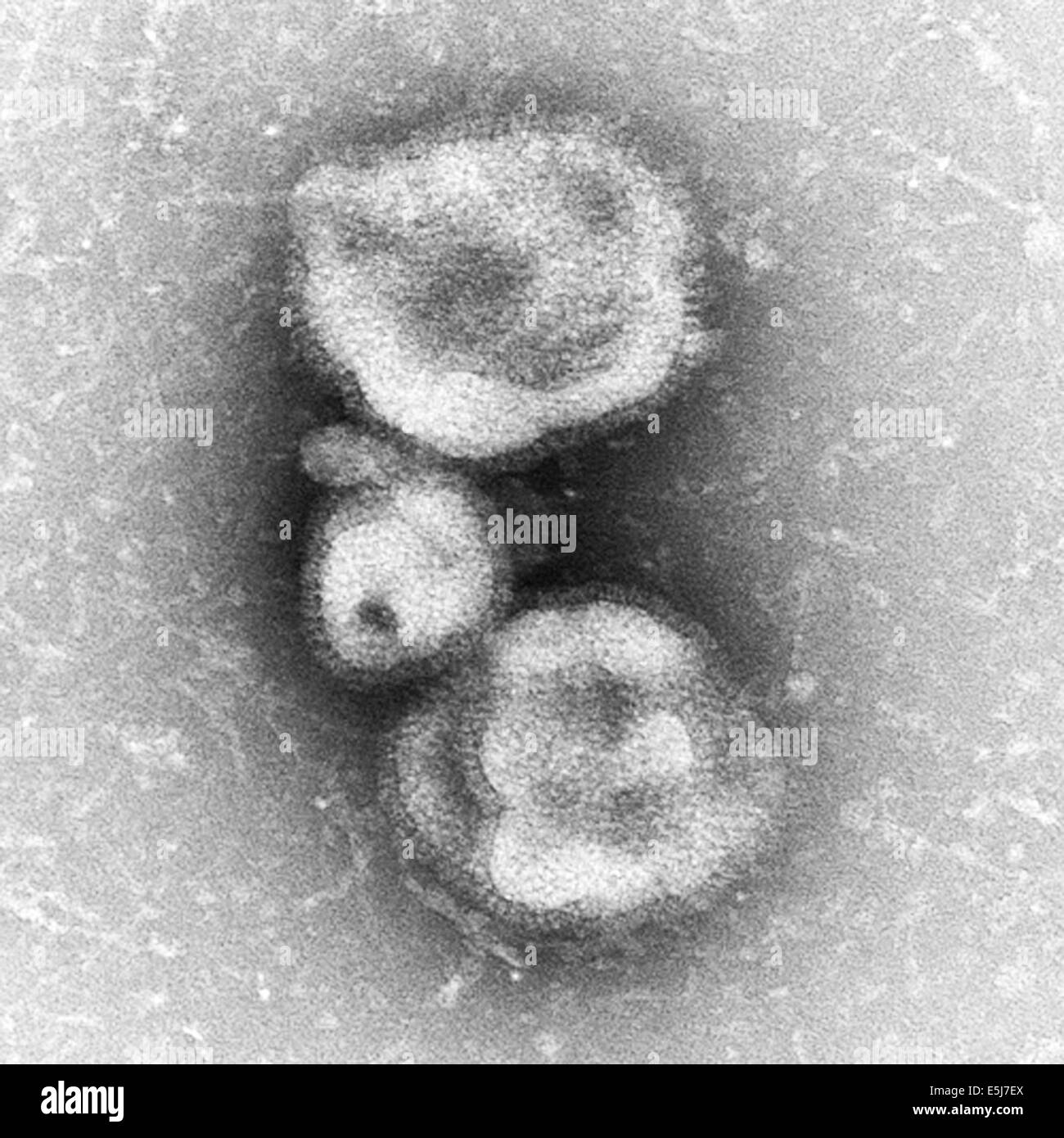 Esférica de la gripe H7N9 virus como vistos a través de un microscopio. Esferas de virus son observados en esta foto de los archivos de prensa servicio vertical Foto de stock