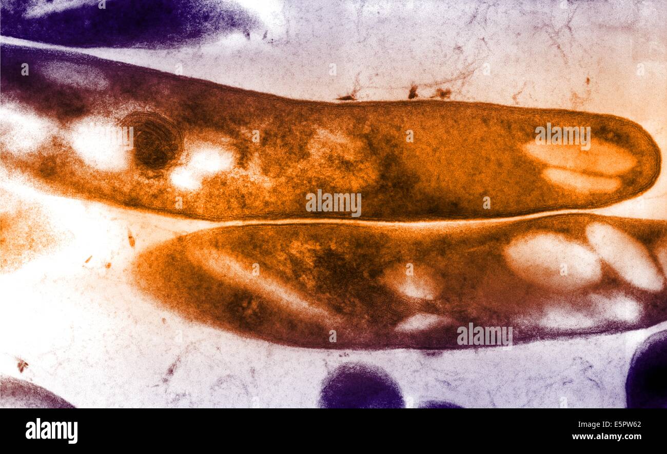 Mycobacterium tuberculosis bacterium fotografías e imágenes de alta ...