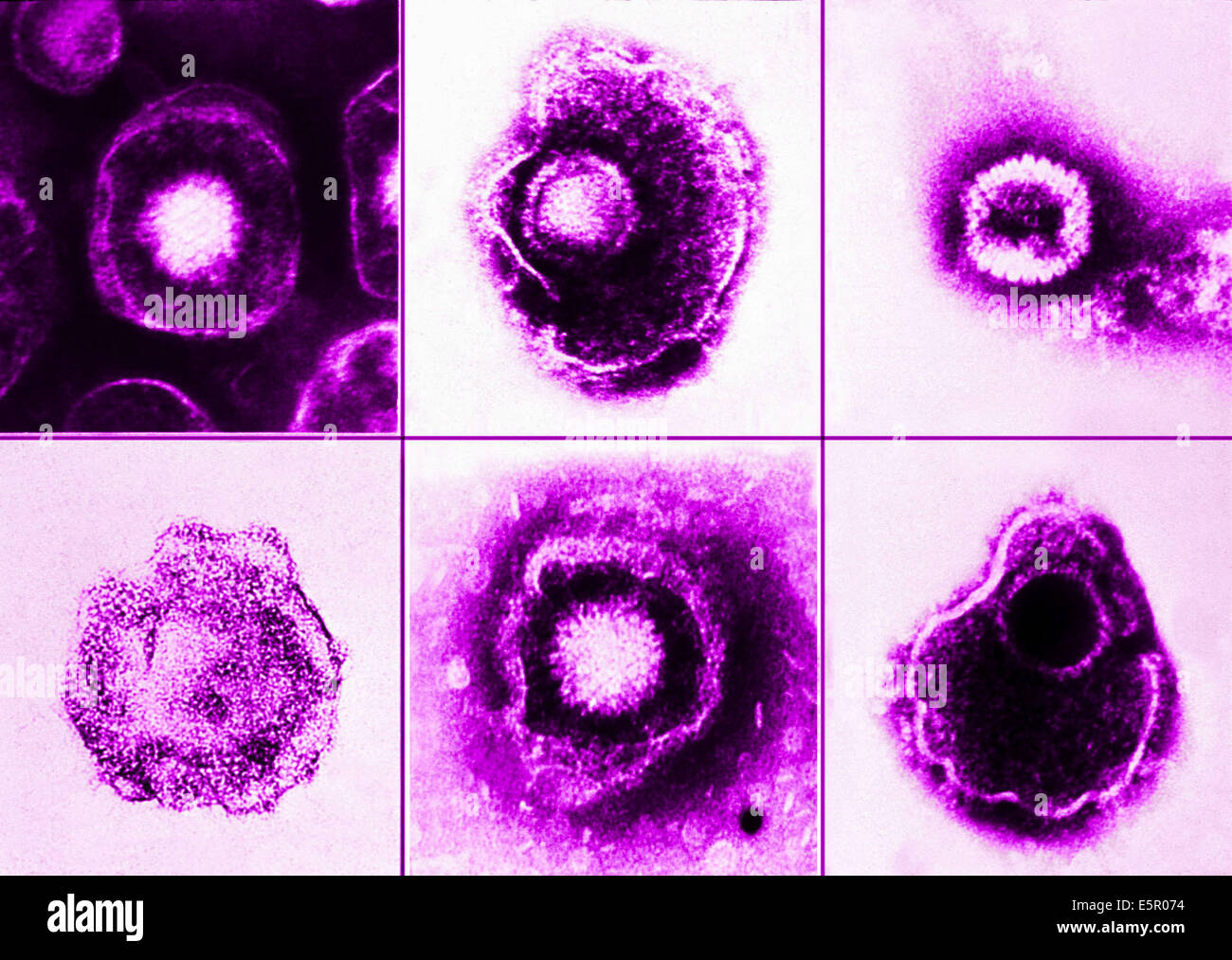 Micrografía de electrones del virus Herpes simplex. Foto de stock