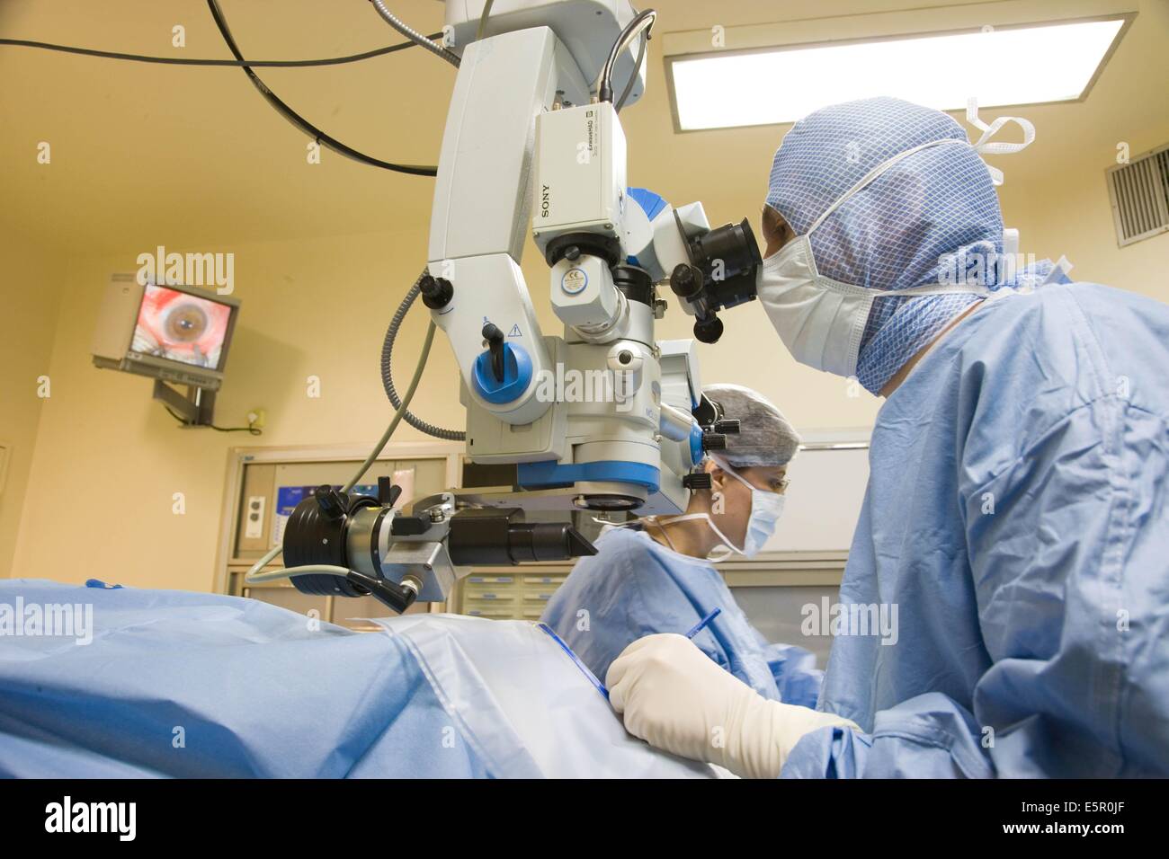 Cirujano Oftalmólogo realiza injerto corneal. Foto de stock
