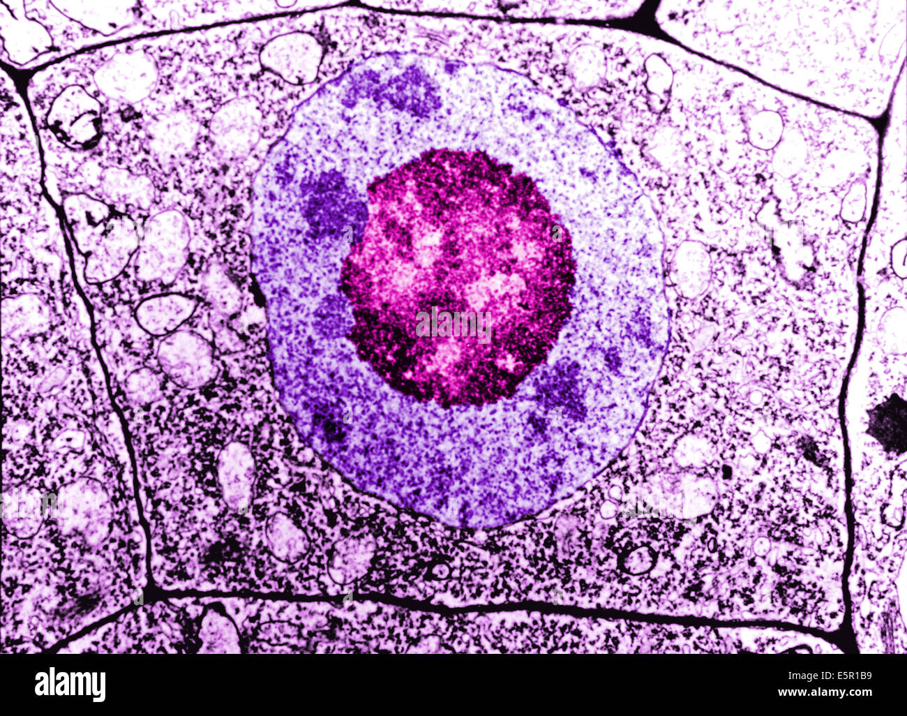 Microscopía electrónica de una célula humana normal, la membrana de la célula, el núcleo y el nuclï¿½lo son distinguibles. Foto de stock