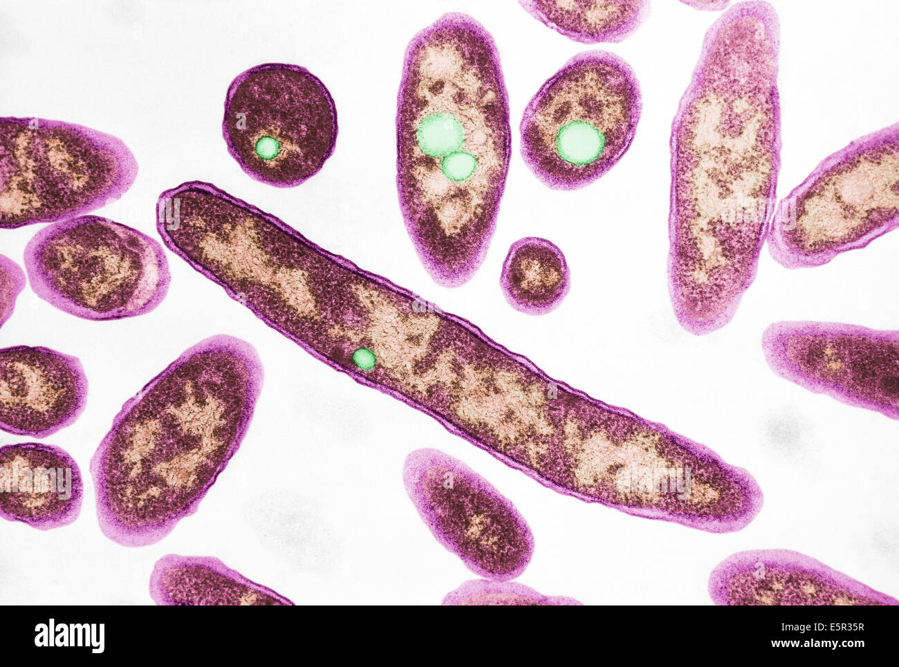 Micrógrafo electrónico de transmisión (TEM) de la bacteria Legionella pneumophila, conocida por causar enfermedad de los legionarios. Foto de stock