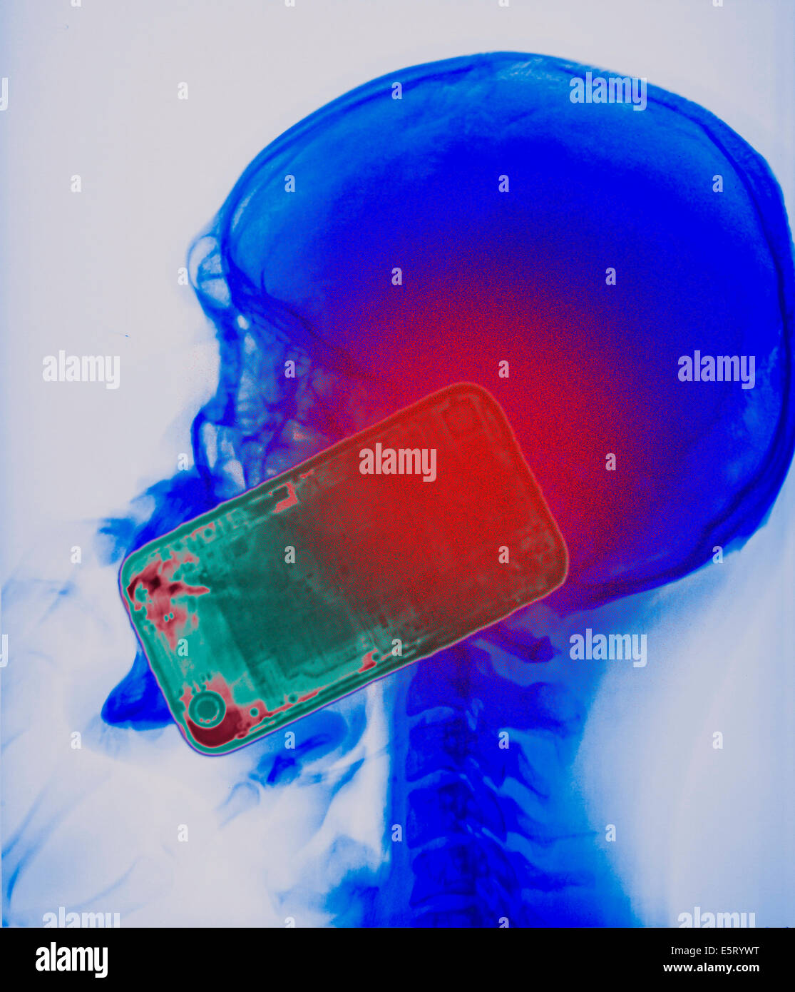 Rayos X de color mostrando la cabeza de un hombre usando un smartphone. El  uso del teléfono móvil genera microondas que penetran en la Fotografía de  stock - Alamy