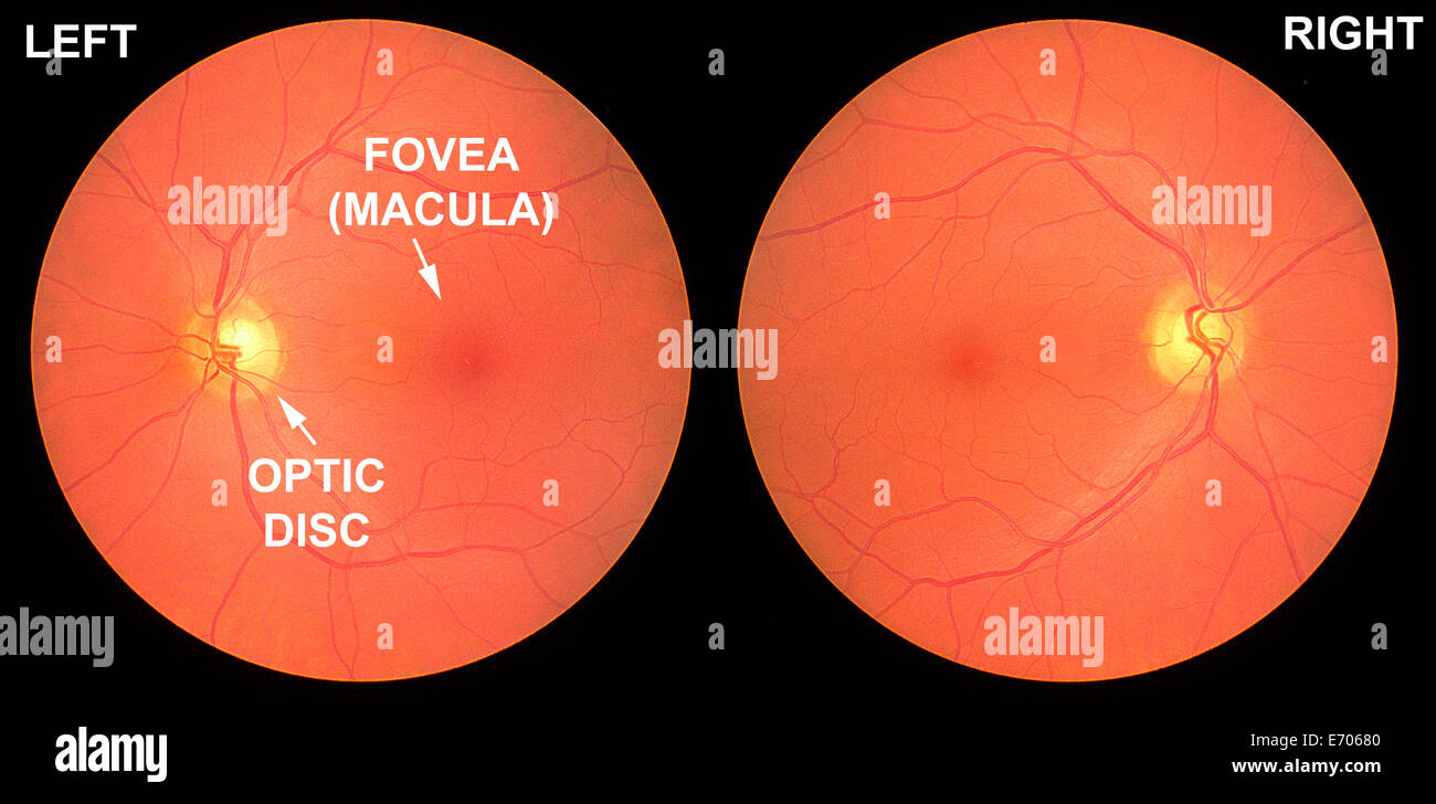 Imagen de fondo de ojo ojo sano masculino edad 58. Mostrando la retina, las  venas Fotografía de stock - Alamy