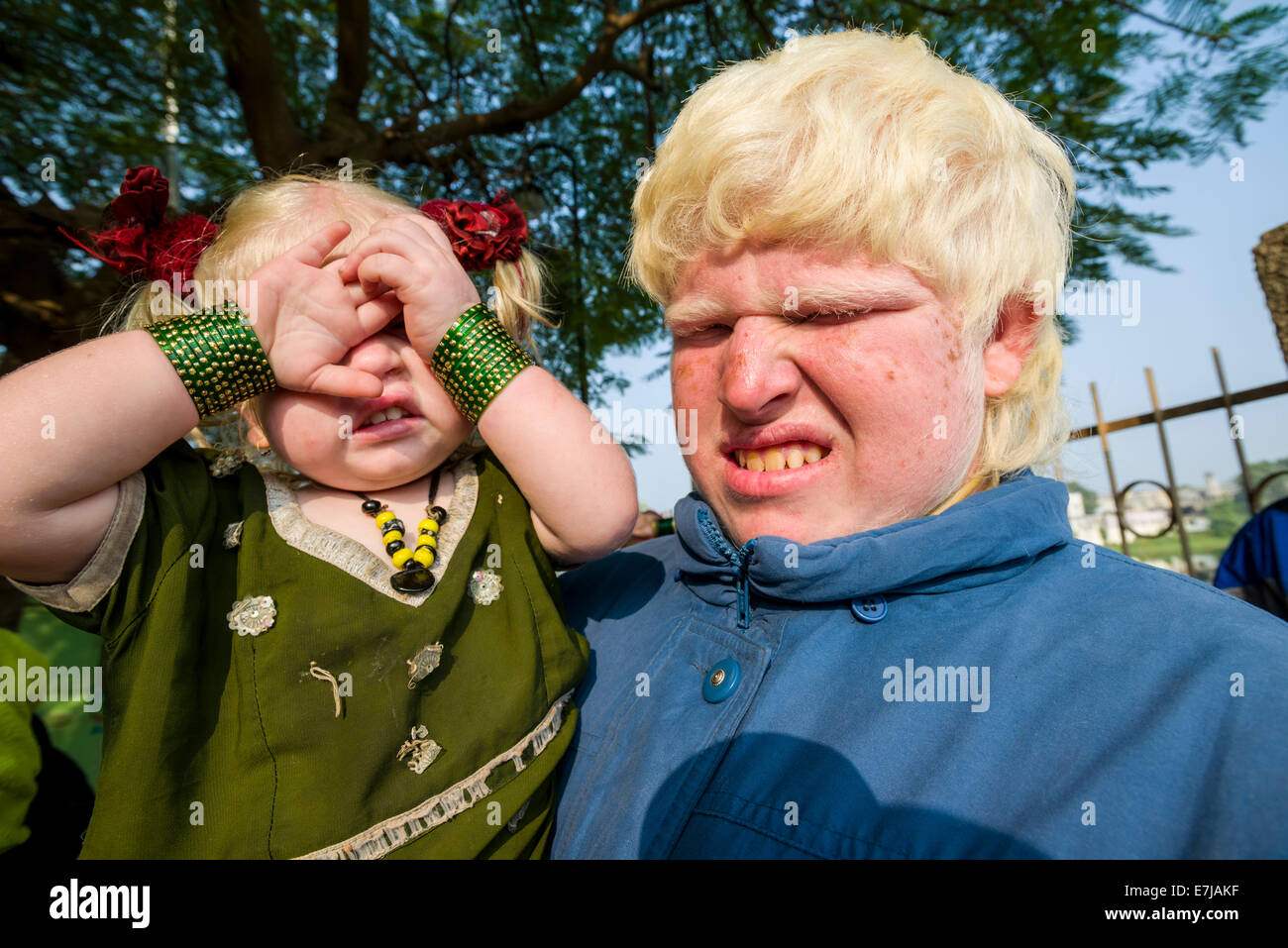 Dos albinos cubriendo y cerrando sus ojos sensibles a partir de la luz solar, Bhavnagar, Gujarat, India Foto de stock
