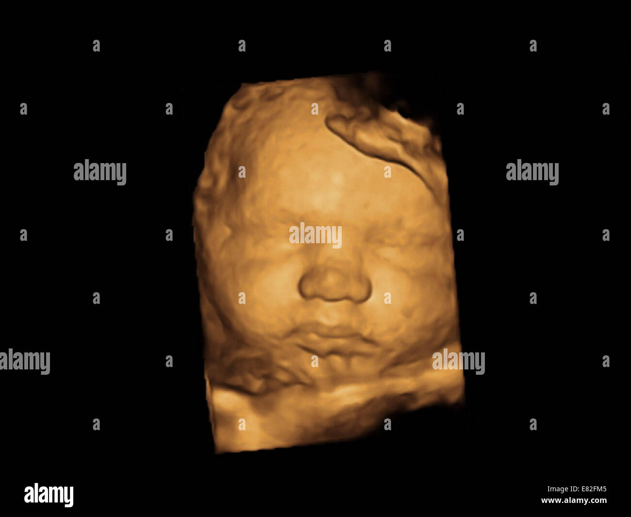 Ultrasonido 3d Fotos E Imagenes De Stock Alamy
