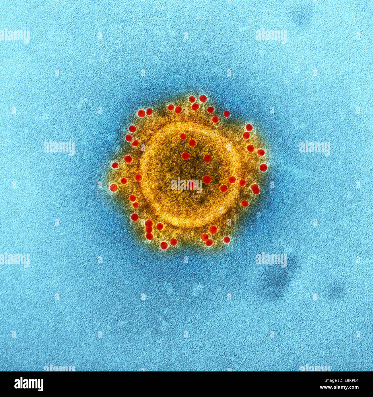 Oriente Medio coronavirus del síndrome respiratorio proteínas de la envoltura de partículas con conejo immunolabeled HCoV-EMC/2012 principal Foto de stock