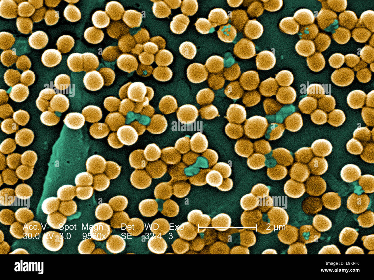 Este análisis micrografía de electrones (SEM) representada numerosas matas de Staphylococcus aureus meticilina-resistente bacterias, Foto de stock
