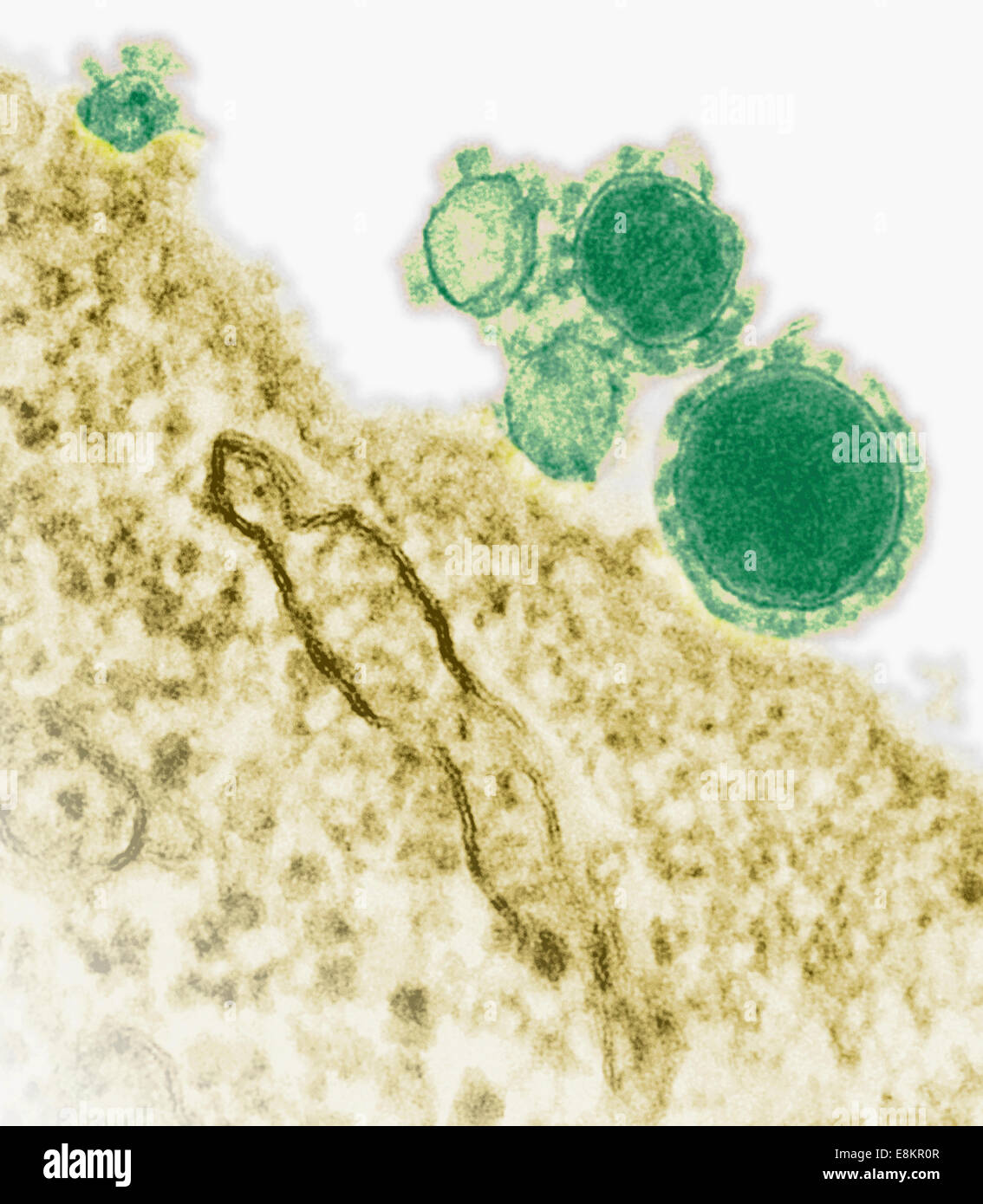 Transmisión coloreada micrógrafo electrónico de Oriente Medio coronavirus del síndrome respiratorio partículas. Foto de stock