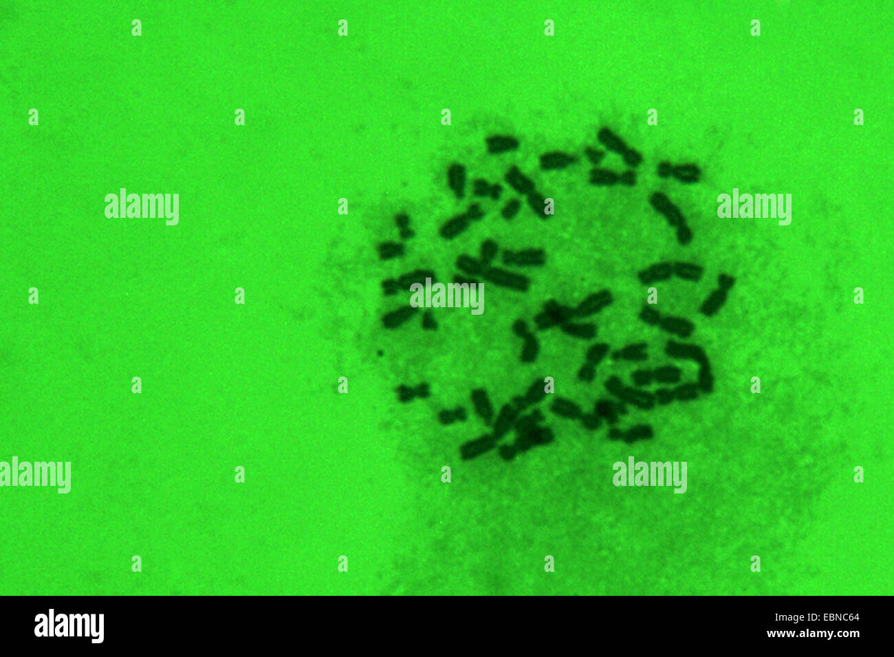 Conjunto de cromosomas humanos de sangre femenina, 1000 x en aceite Foto de stock