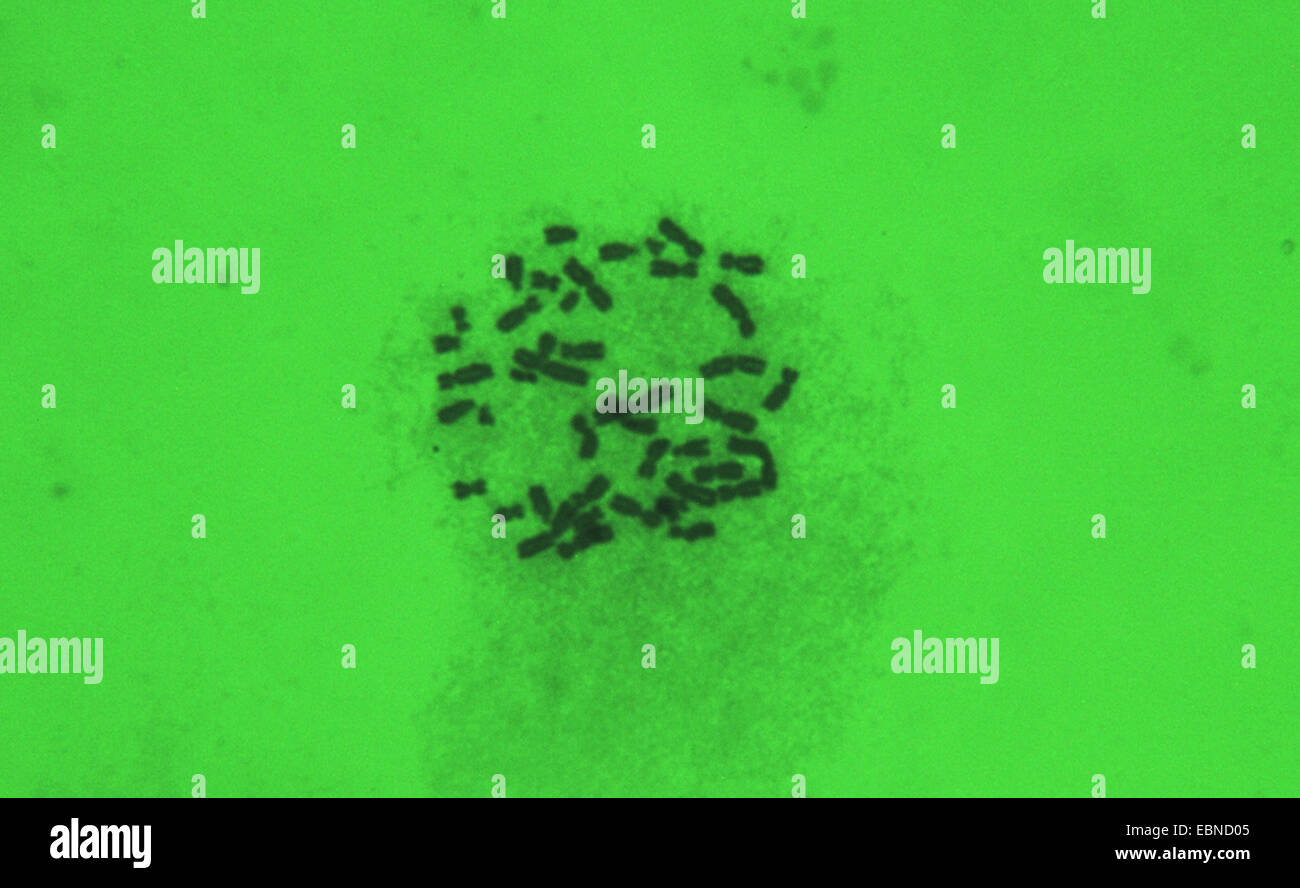 Conjunto de cromosomas humanos de sangre femenina, 1000 x en aceite Foto de stock