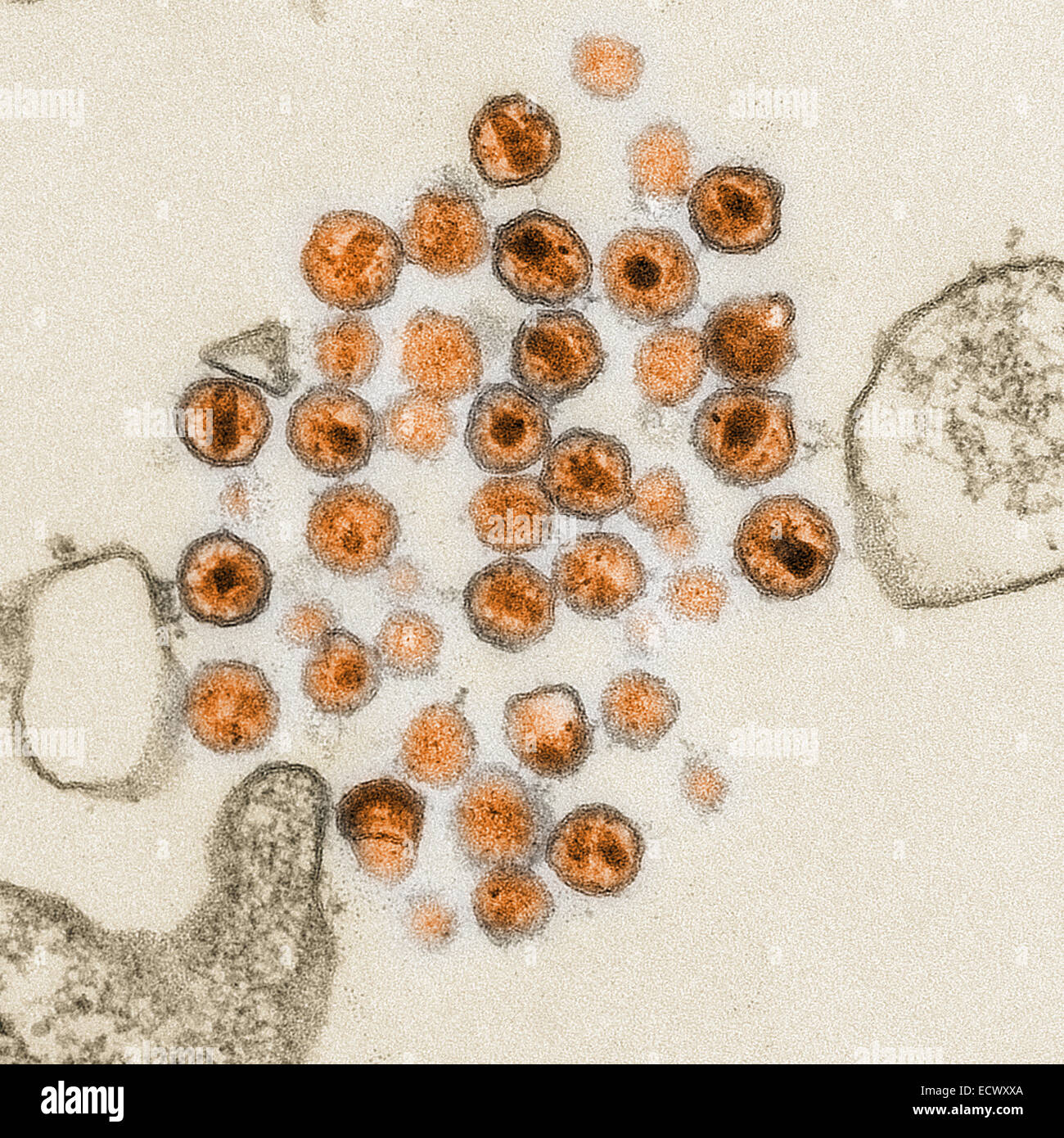 Micrografía de electrones del virus de la Inmunodeficiencia Humana, VIH. Foto de stock