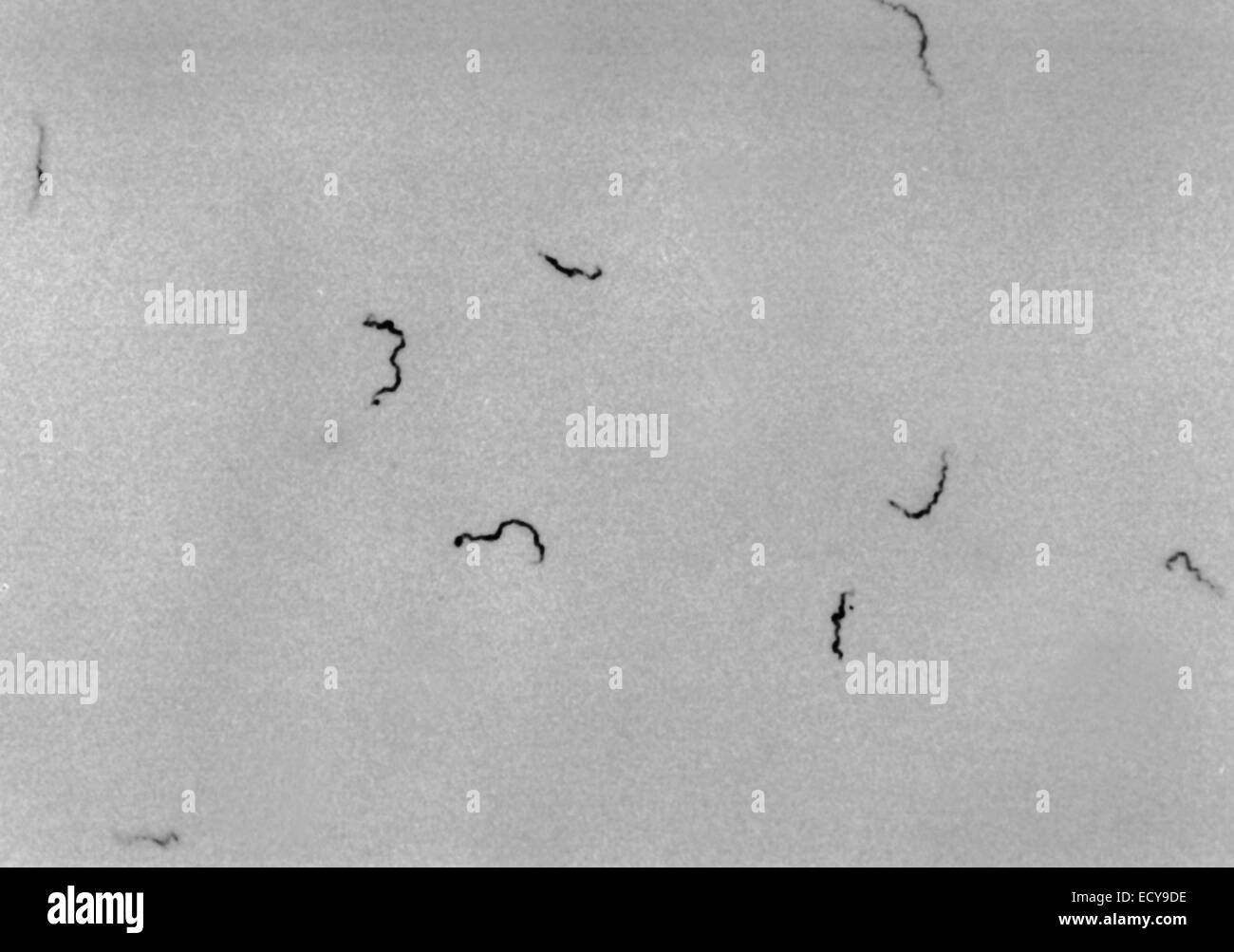 Treponema Pallidum Bacteria Fotos e Imágenes de stock Alamy Treponema Pallidum Bacteria Fotos e Imágenes de stock Alamy