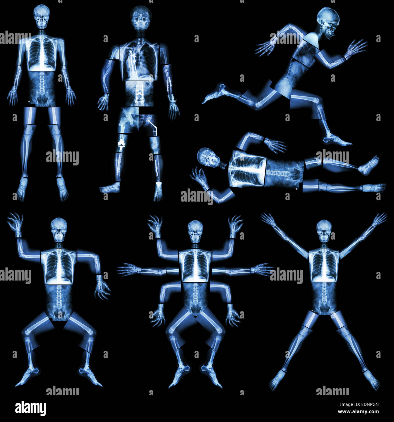Colección de esqueleto humano (rayos X todo el cuerpo : cráneo la cara de la cabeza de la columna vertebral del cuello del brazo hombro codo antebrazo muñeca mano dedo torax Foto de stock