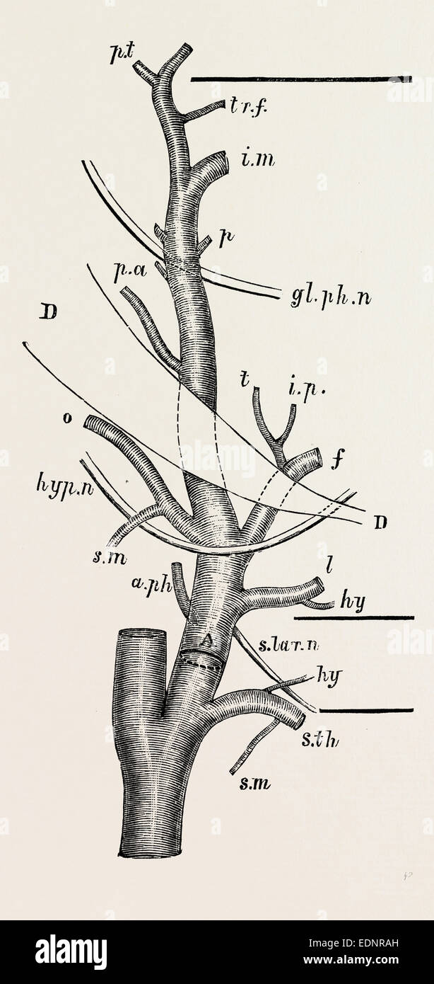Arteria carótida externa; tamaño natural, modificado de quain, equipos médicos, instrumentos quirúrgicos, historia de la medicina. Foto de stock