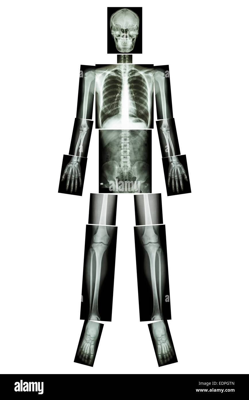 Posición anatómica. (Rayos X todo el cuerpo: cabeza, cuello, tórax ,corazón ,pulmón ,costilla ,hombro ,escápula ,el brazo ,antebrazo ,el codo ,muñeca ,ha. Foto de stock