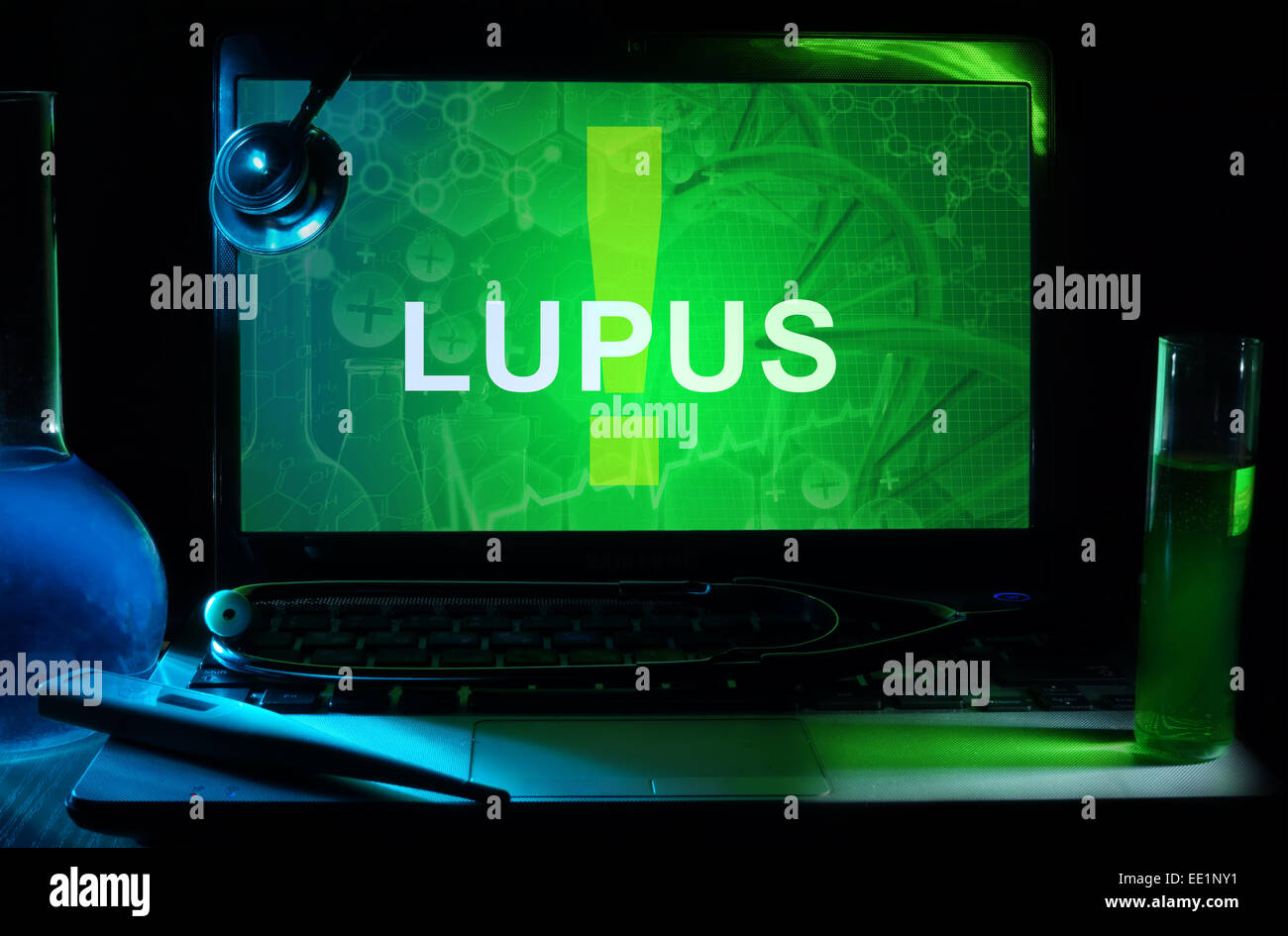 Portátil con palabras Lupus, tubos de ensayo y estetoscopio Foto de stock