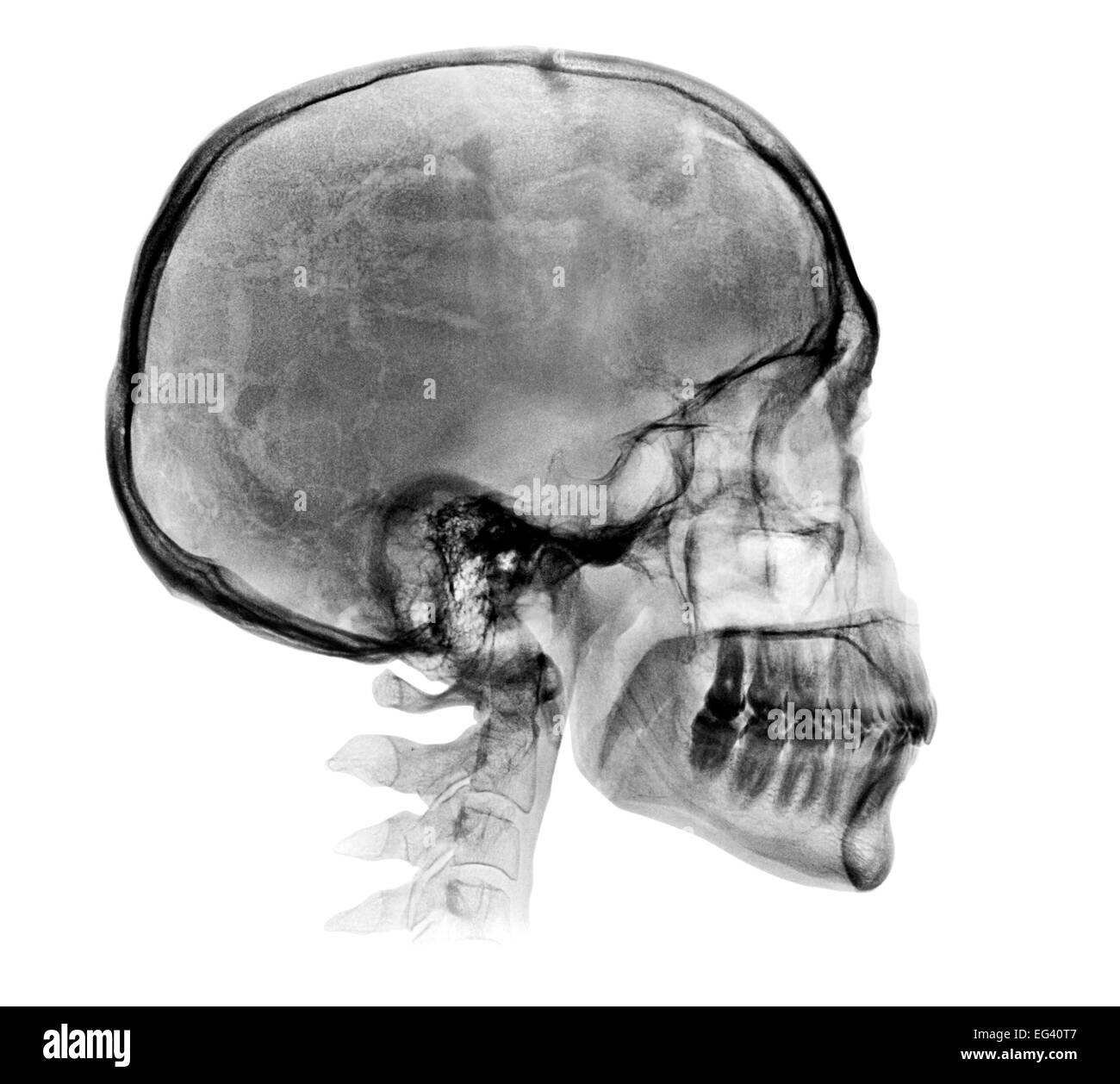Radiografía del cráneo humano aislado en blanco de la imagen Fotografía