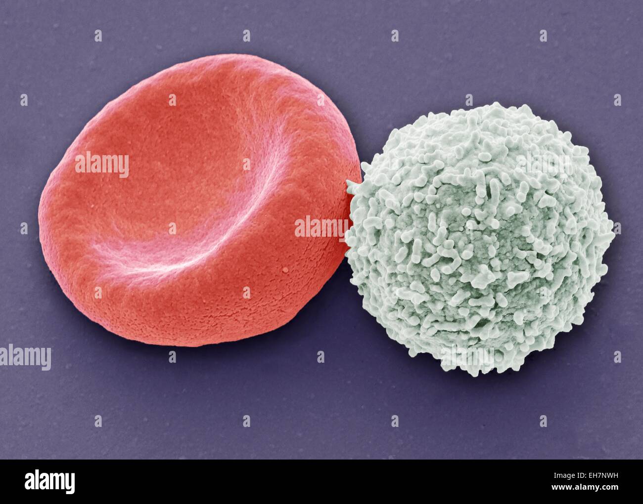 Leucocito microscopio electrónico fotografías e imágenes de alta resolución  - Alamy