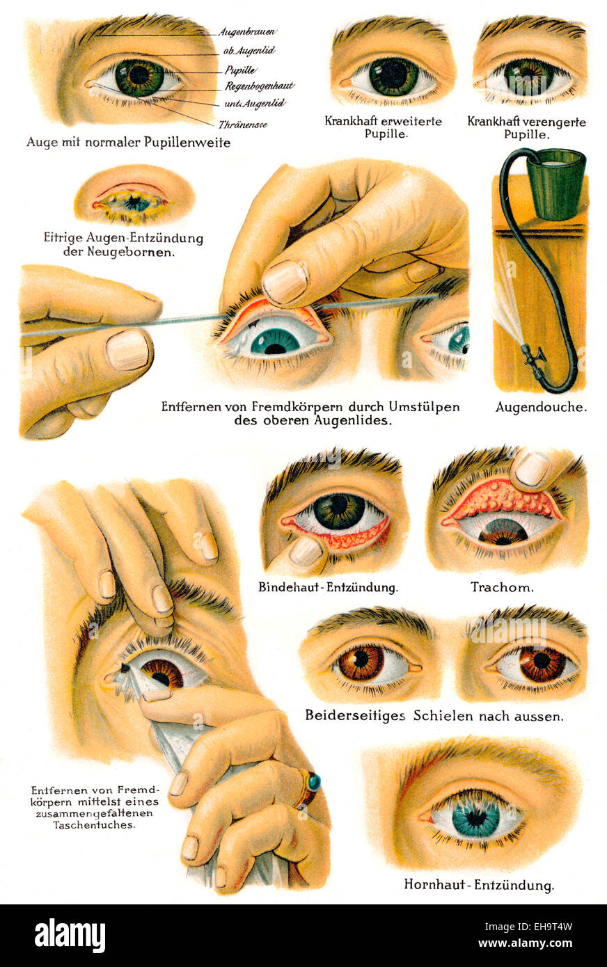 Diversas enfermedades oculares, consejero de salud del siglo XIX. Foto de stock