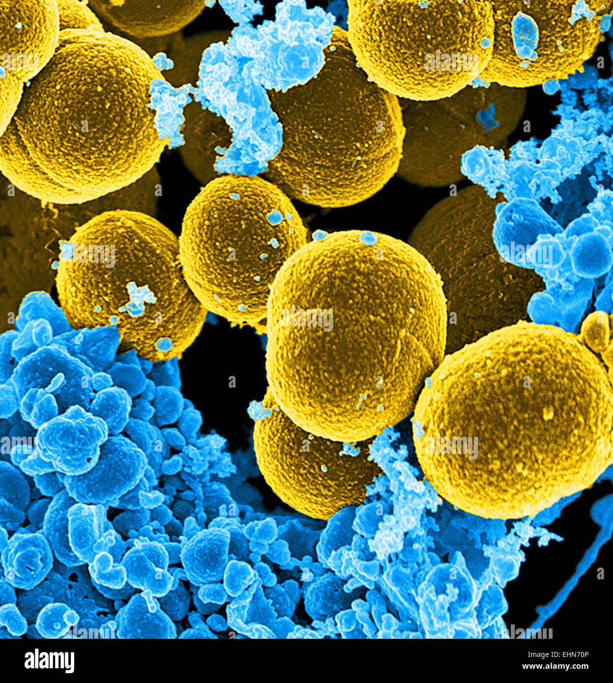Color análisis micrografía de electrones (SEM) de Staphylococcus aureus meticilino-resistente (SAMR) bacterias. Foto de stock