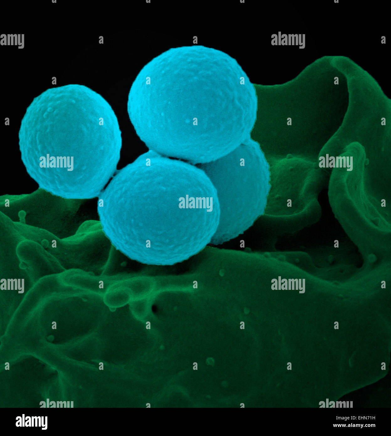 Color análisis micrografía de electrones (SEM) de Staphylococcus aureus meticilino-resistente (SAMR) bacterias. Foto de stock