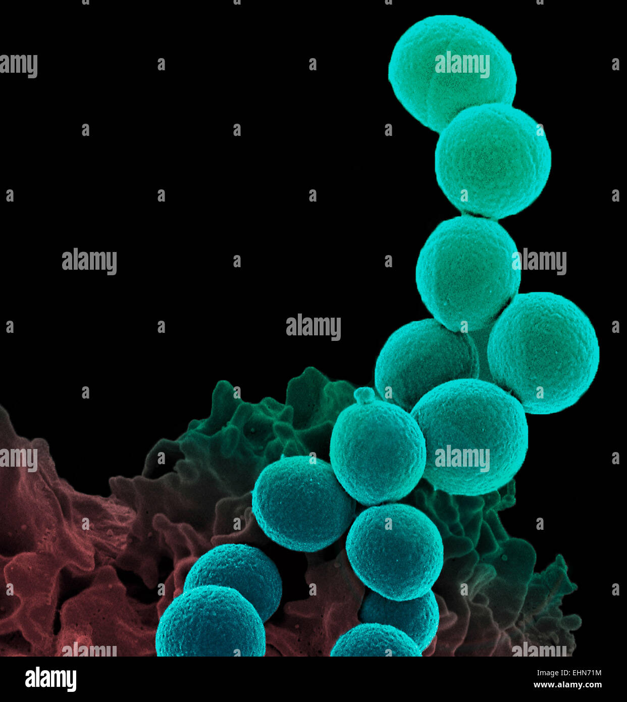 Color análisis micrografía de electrones (SEM) de una célula de sangre blanca de neutrófilos (abajo) invadiendo de Staphylococcus aureus resistente a la meticilina (MRSA bacterias, amarillo). Foto de stock