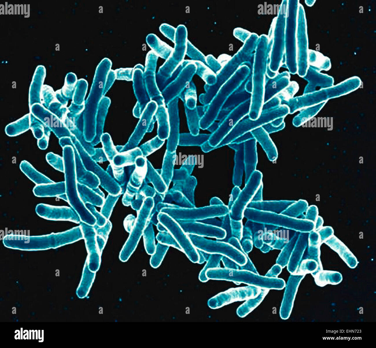Mycobacterium tuberculosis, estas bacterias gram-positivas en forma de varilla bacterias causan la enfermedad tuberculosis, colorea el análisis micrografía de electrones (SEM). Foto de stock