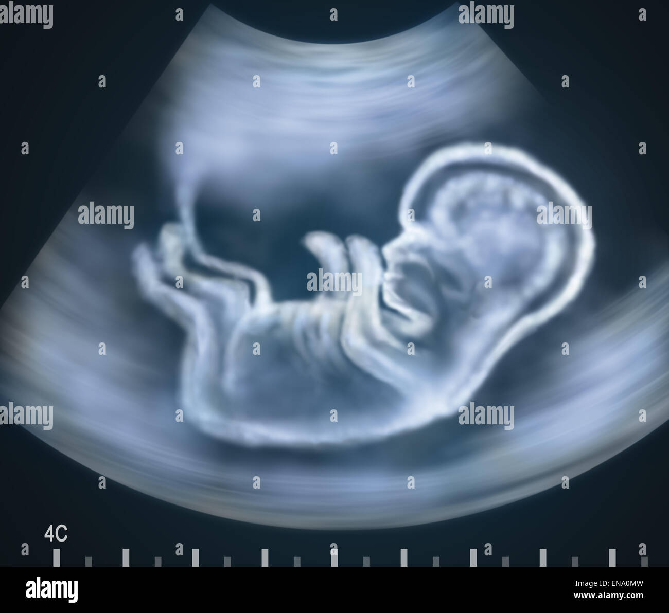 Imagen De Ultrasonido Del Bebe En El Vientre Materno Concepto Fotografia De Stock Alamy