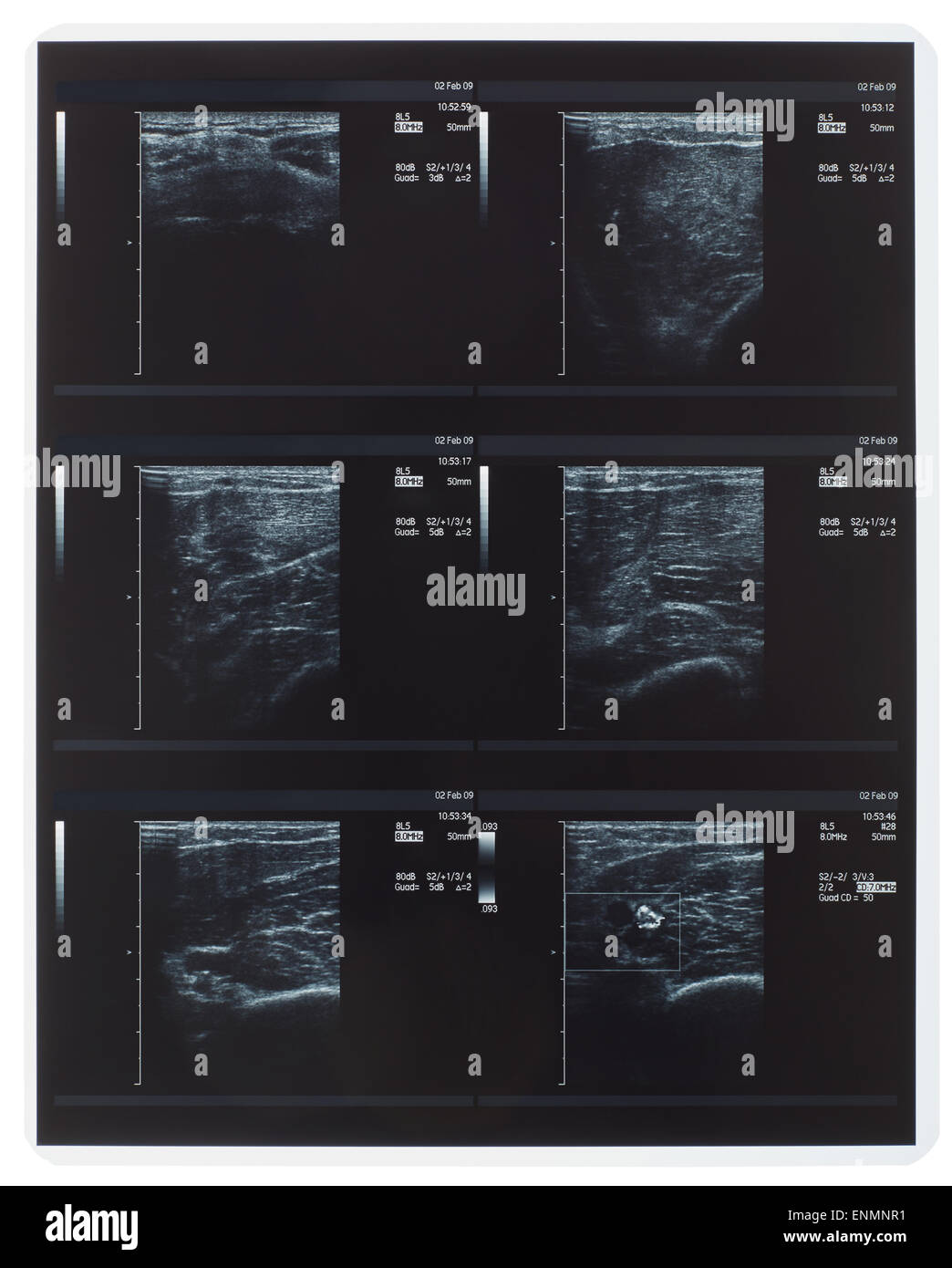 Los rayos X, ultrasonidos muscular Foto de stock