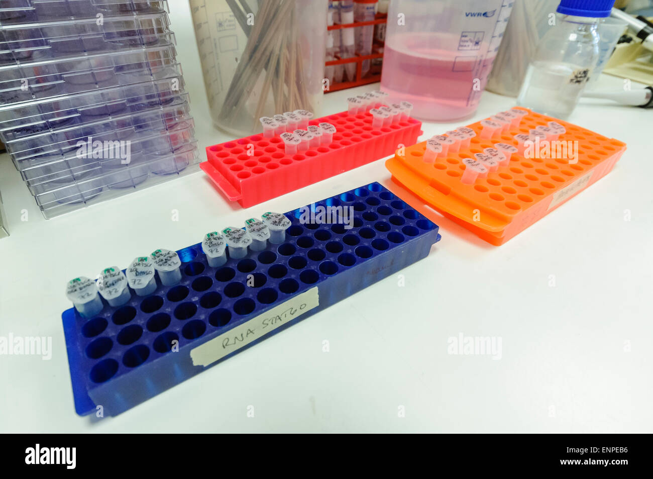 Las muestras listo para ser probado en un laboratorio de investigación del cáncer Foto de stock