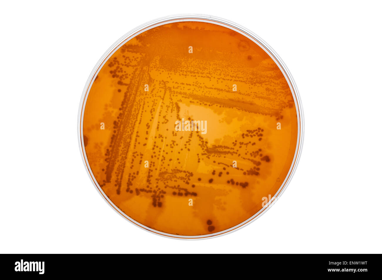Agar MacConkey agar selectivo de un laboratorio de microbiología clínica de  medio de cultivo para aislar bacterias Gram-negativos y bacilos entéricos  bacterias Fotografía de stock - Alamy