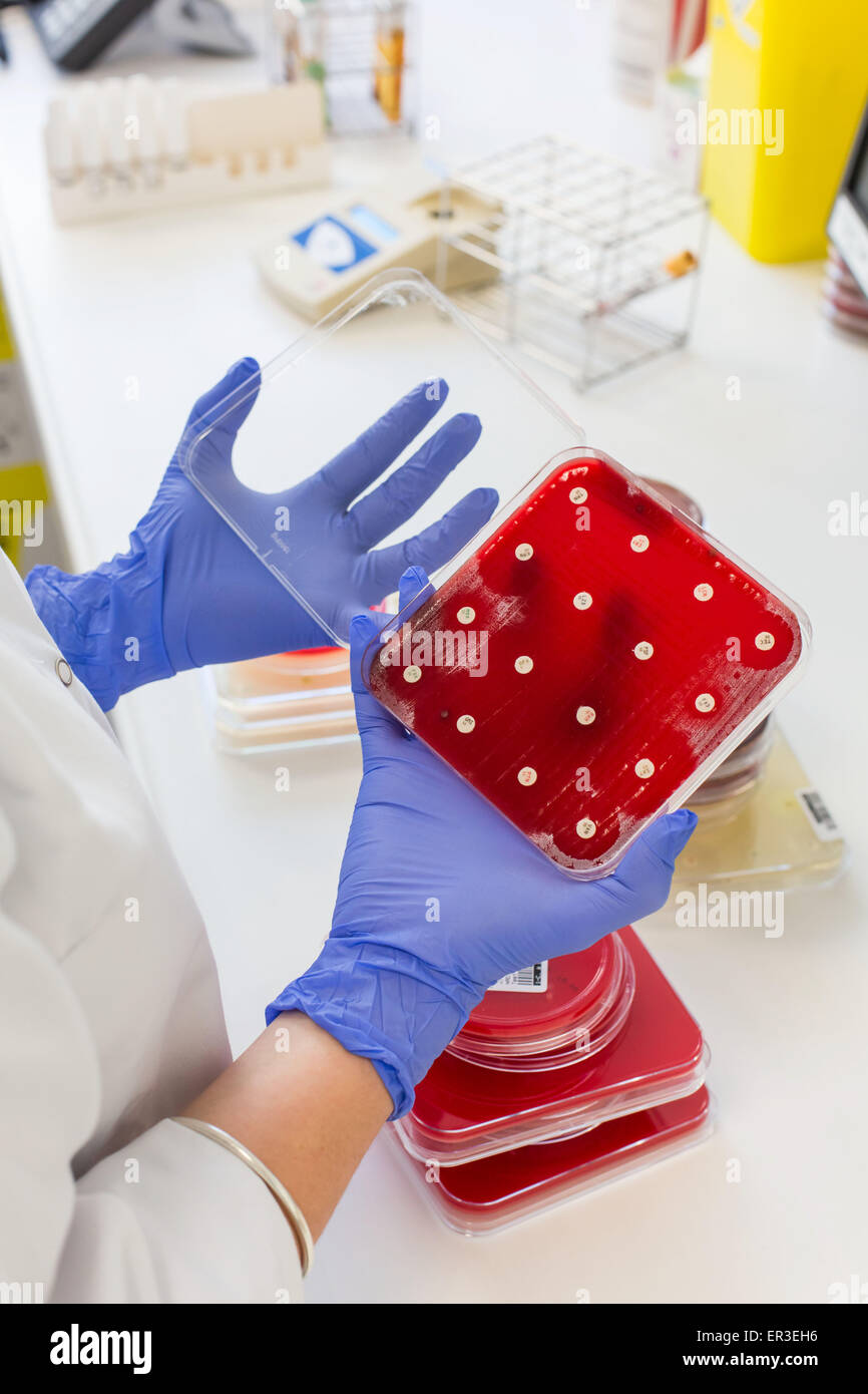 Siembra bacteriana y la preparación de una susceptibilidad en una placa de Petri. Laboratorio de Bacteriología y Virología. Foto de stock