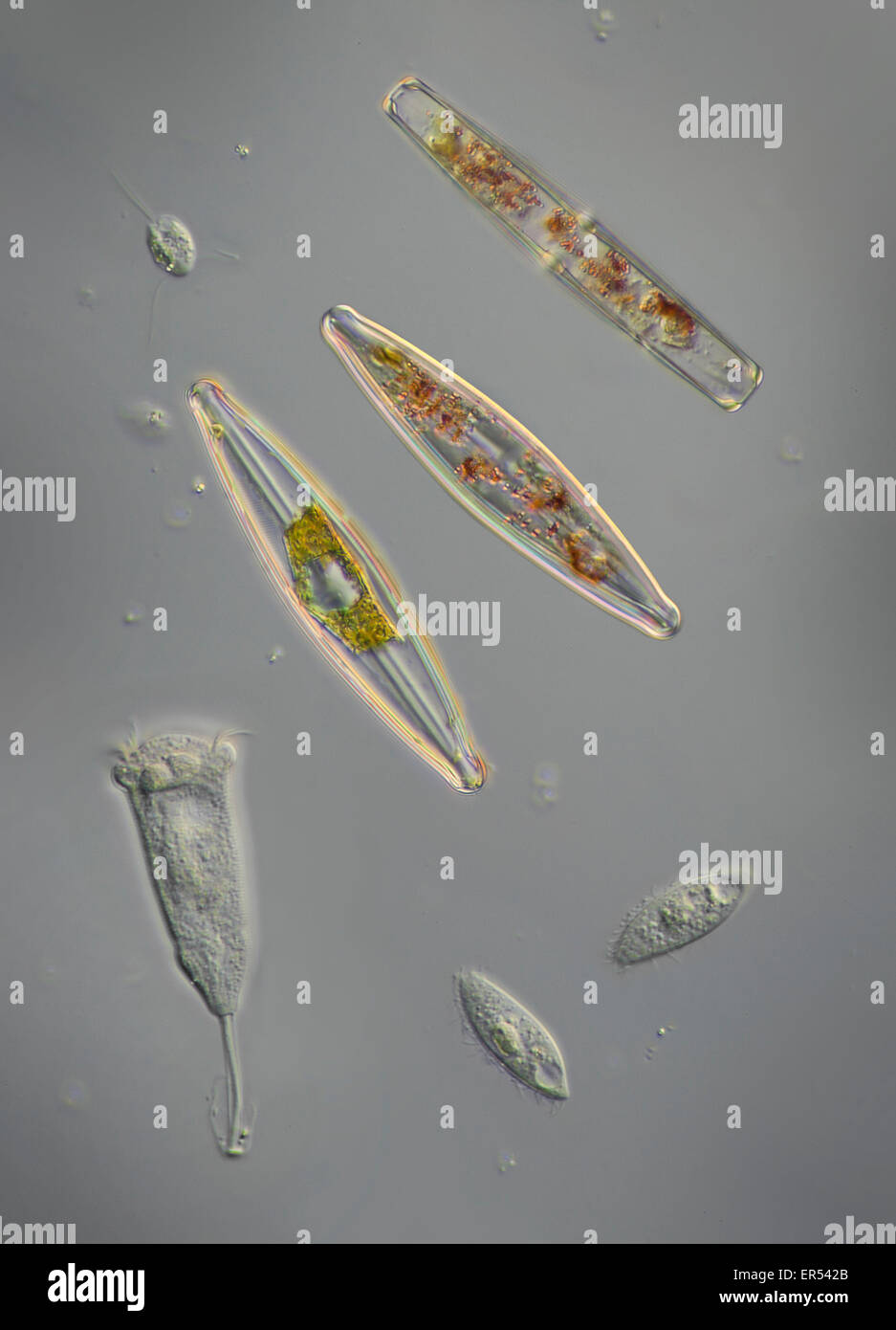 Una variedad de pondlife, diatomeas. protozoos ciliados peritrich scuticociliates, -- probablemente Vorticella, Carchesium Foto de stock