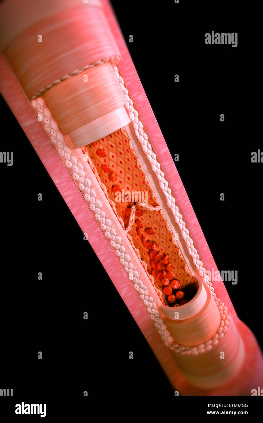Ilustración mostrando una vena con una sección transversal para revelar la anatomía interna, incluidas las válvulas y el flujo sanguíneo. Foto de stock