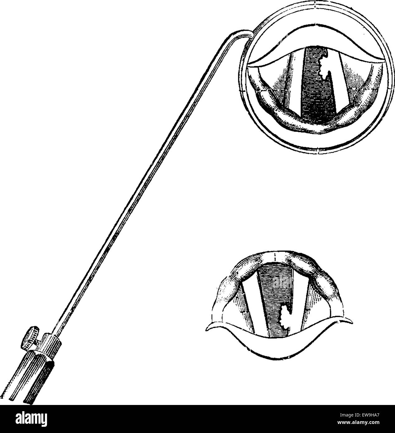 Partes de la laringe, visto a través de un espejo laríngeo, vintage  ilustración grabada. Diccionario de medicina habitual por el Dr. Labarthe  Imagen Vector de stock - Alamy