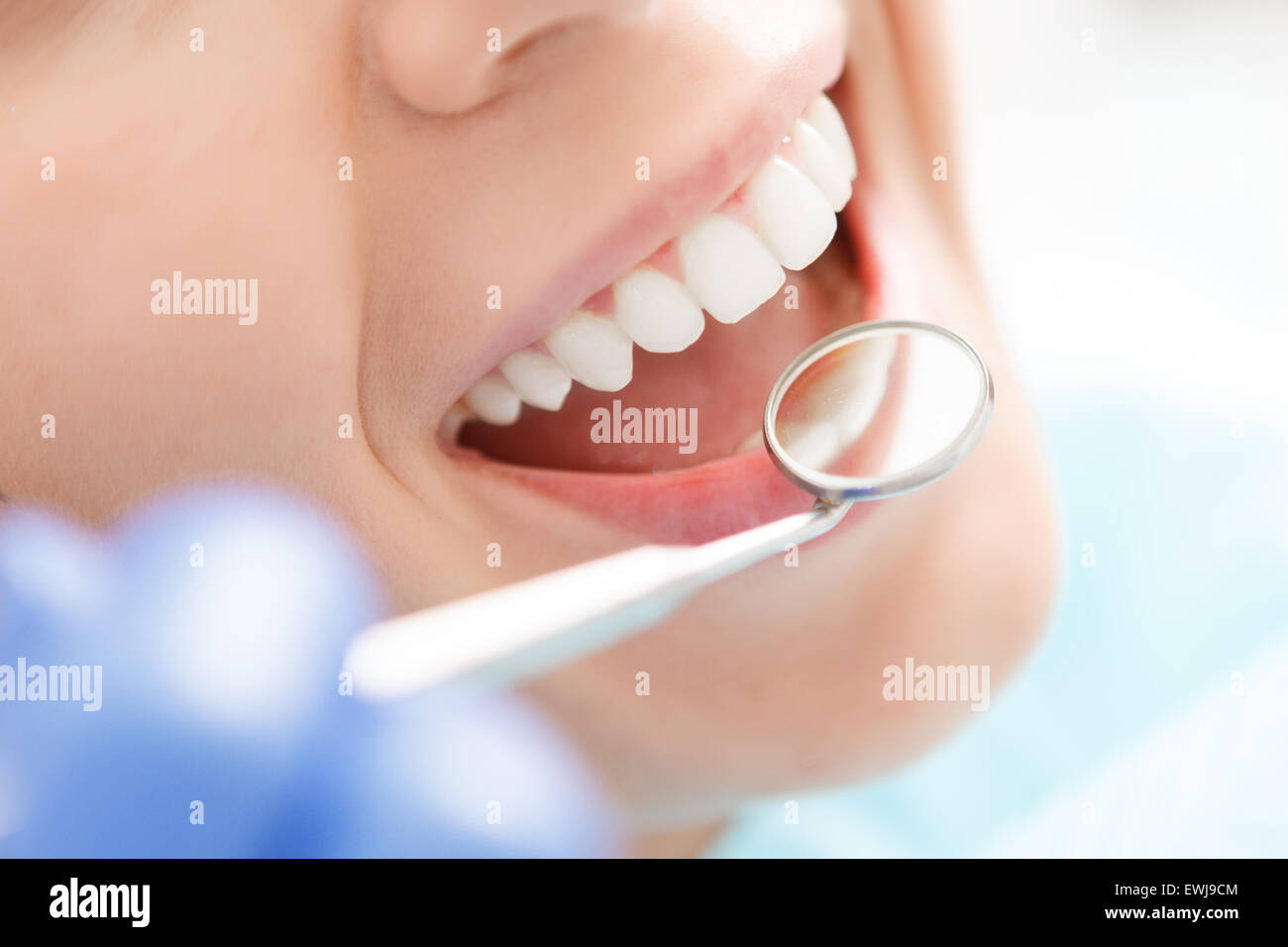 Close-up de una mujer con sus dientes examinados Foto de stock