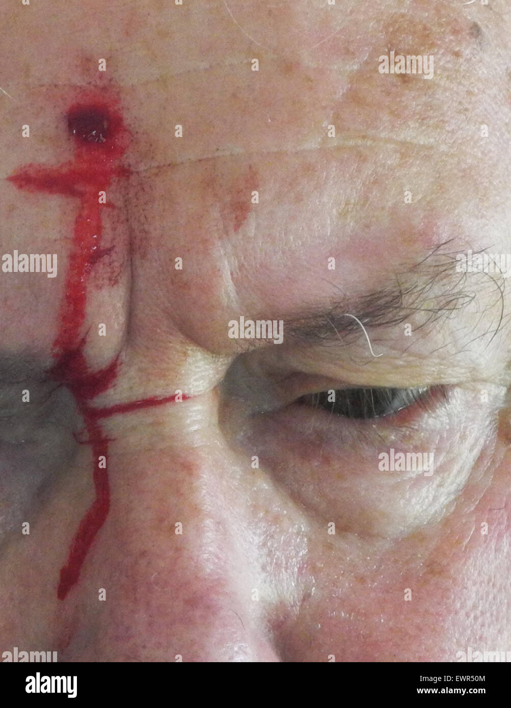 Shot herida de bala en la cabeza el sangrado de lesiones de disparo de arma de fuego - Modelo de liberación libera Foto de stock