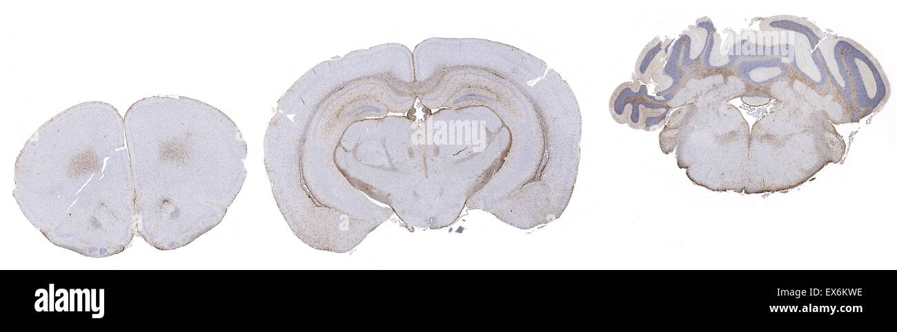 GFAP: la tinción inmunoperoxidasa de fijadas con formalina, parafina de cerebro de ratón mostrando citoplasma tinción de los astrocitos. Foto de stock