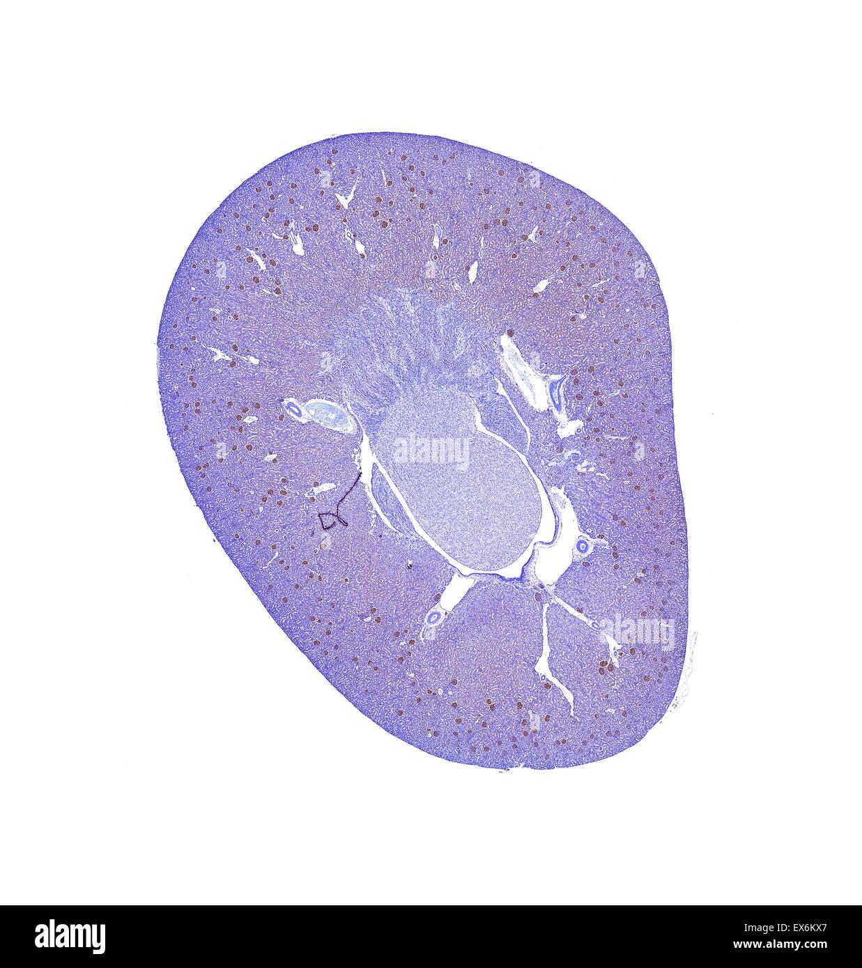 C3: la tinción inmunoperoxidasa de fijadas con formalina, parafina de riñón de rata mostrando la tinción del citoplasma de los glomérulos. Foto de stock