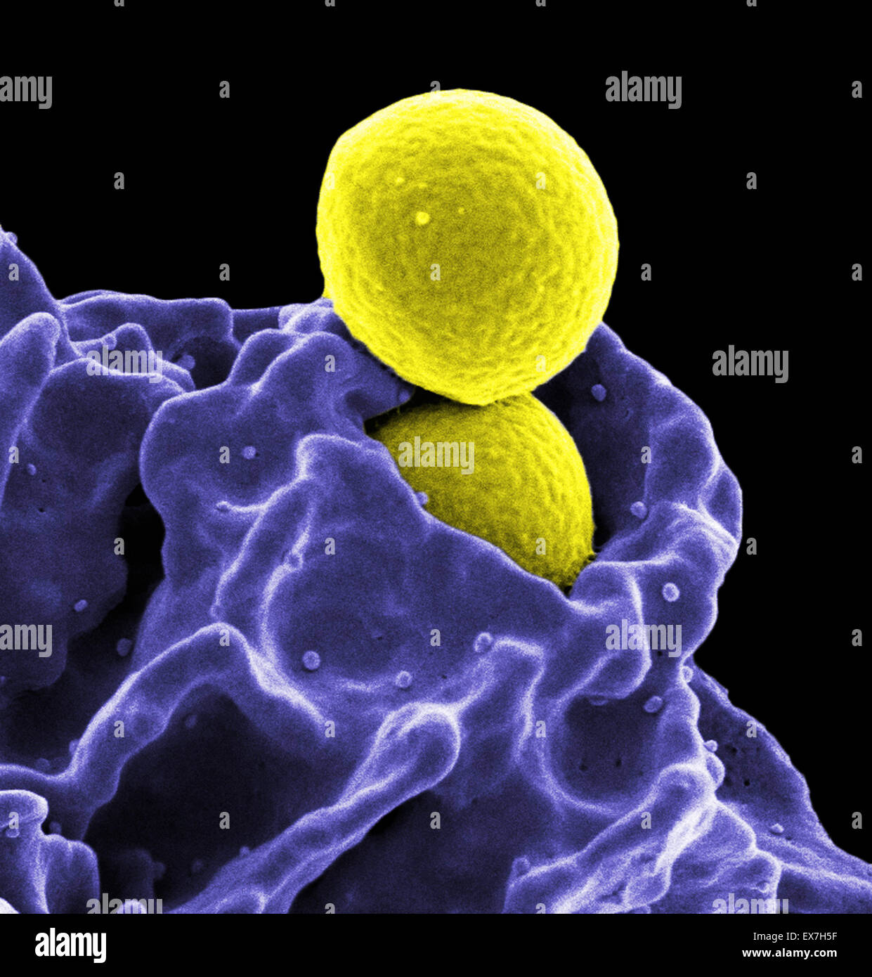 Colorea el análisis micrografía de electrones (SEM) de dos esféricos de Staphylococcus aureus resistente a la meticilina (MRSA) las bacterias. Foto de stock